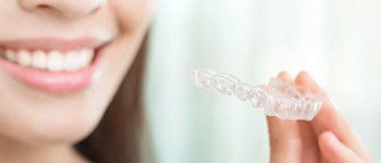 cosmetic braces, Cosmetic Braces